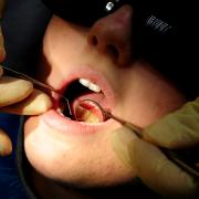 Wirral MP calls for improved dental care for all children