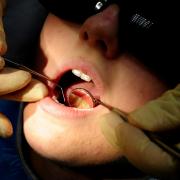Hundreds of Wirral children in hospital to get rotten teeth removed